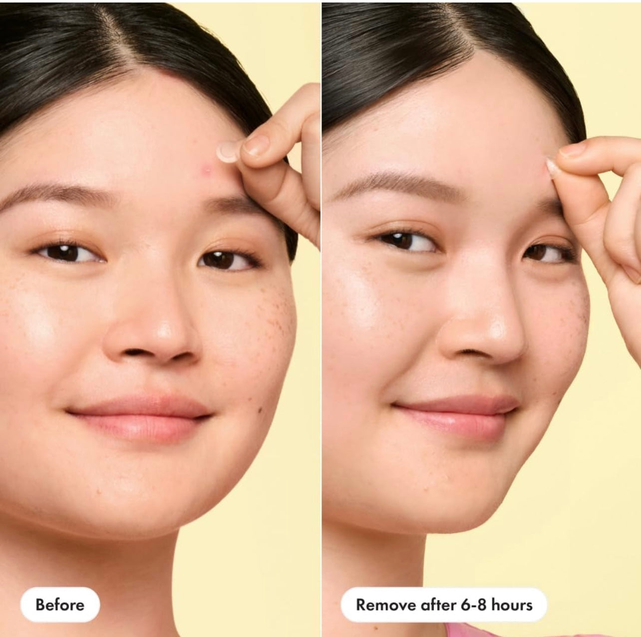 Mighty Patch - Invisible Pimple Patch (39 Ct) Acne Spot Treatment